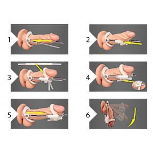 Extensor de pene negro PUMPED